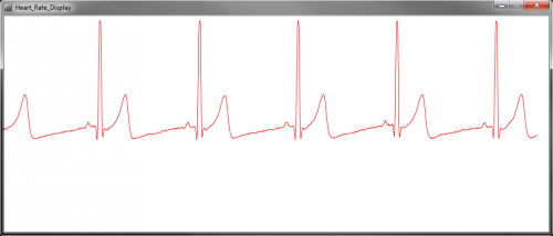 HeartRate_Normal.png