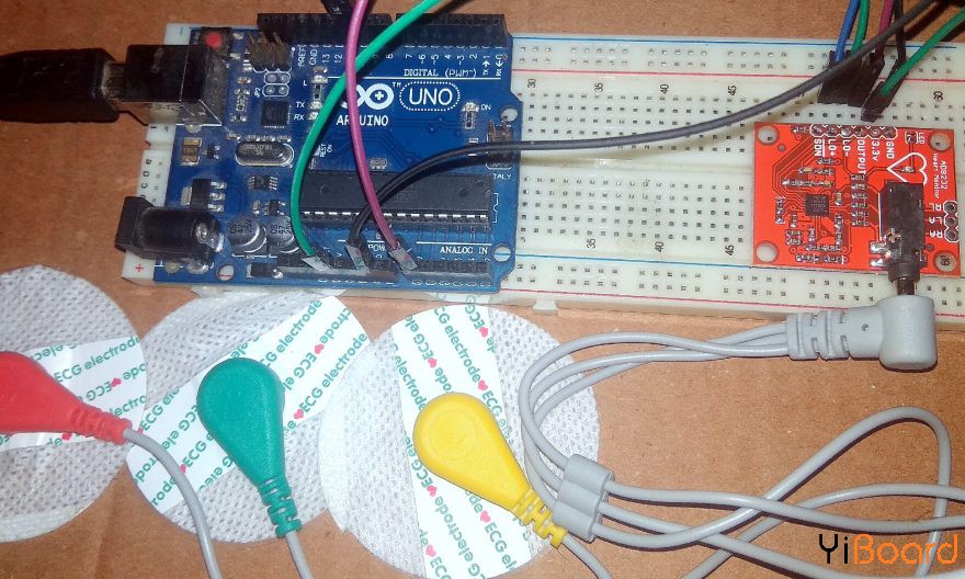 ECG-Monitoring-with-AD8232-ECG-Sensor-Arduino-with-ECG-Graph.jpg