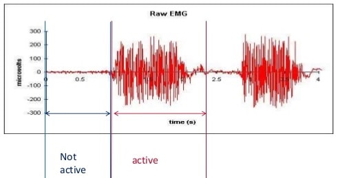 EMG-Signal.jpg