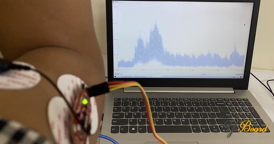 EMG-Muscle-Sensor-Arduino.jpg