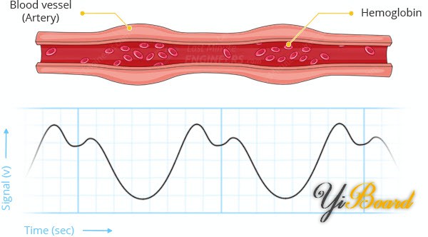 Pulse-Detection-Heart-Rate-Sensor-Working-Photoplethysmogram.jpg